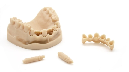 stampa-3d-modello-dentale-monconi-produzione-yndetech