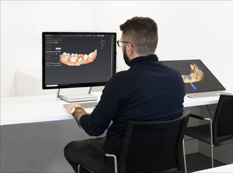 servizio-progettazione-dentale-cad-odontotecnico-digitale-yndetech